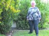 lipoedema